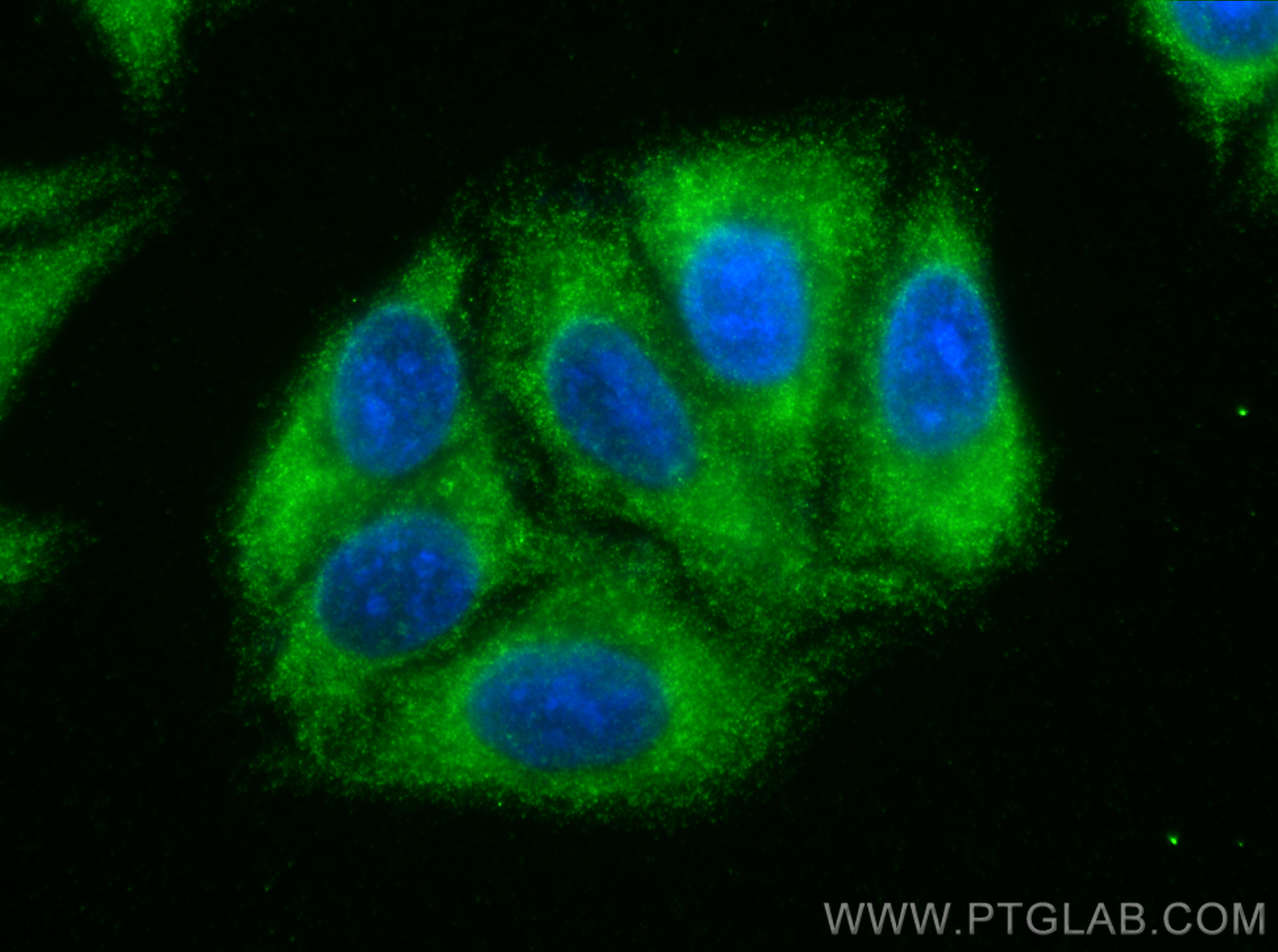 Immunofluorescence (IF) / fluorescent staining of HepG2 cells using LOXL2 Polyclonal antibody (15232-1-AP)