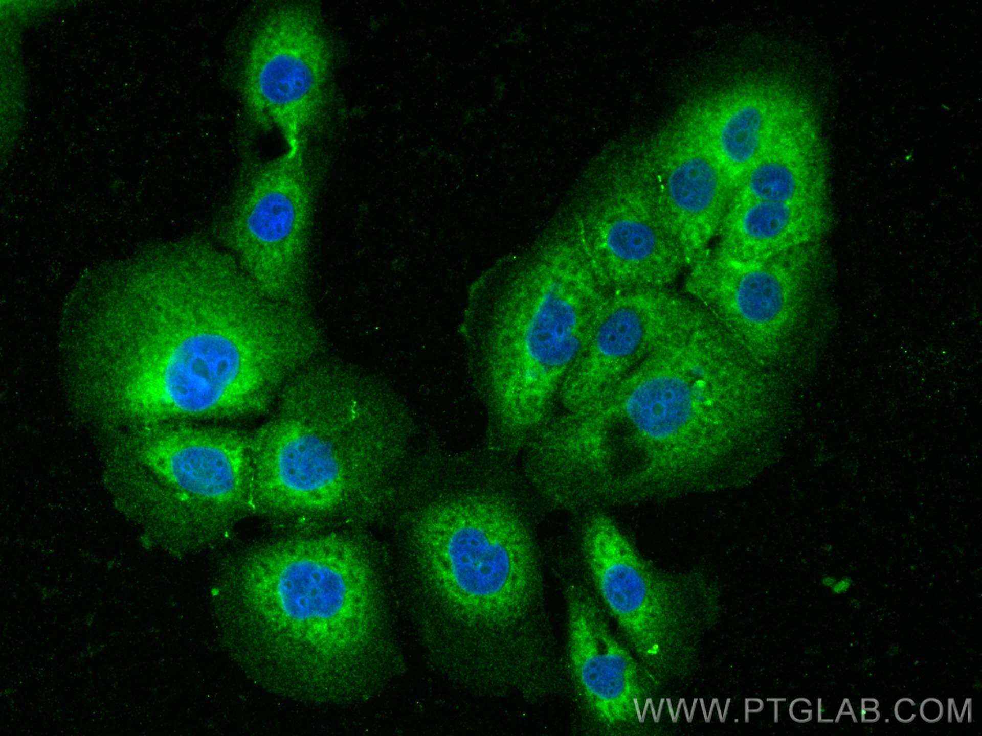 Immunofluorescence (IF) / fluorescent staining of SW 1990 cells using LPAR4 Polyclonal antibody (22165-1-AP)