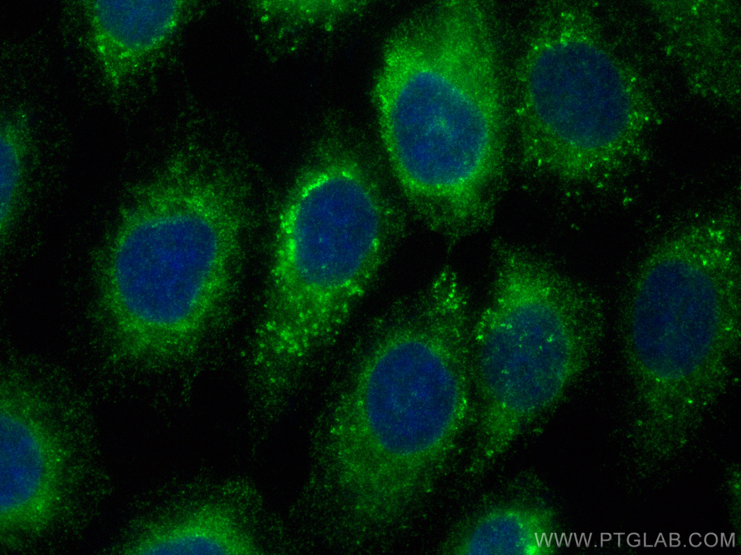 Immunofluorescence (IF) / fluorescent staining of A431 cells using CoraLite® Plus 488-conjugated LPCAT2 Polyclonal an (CL488-15082)