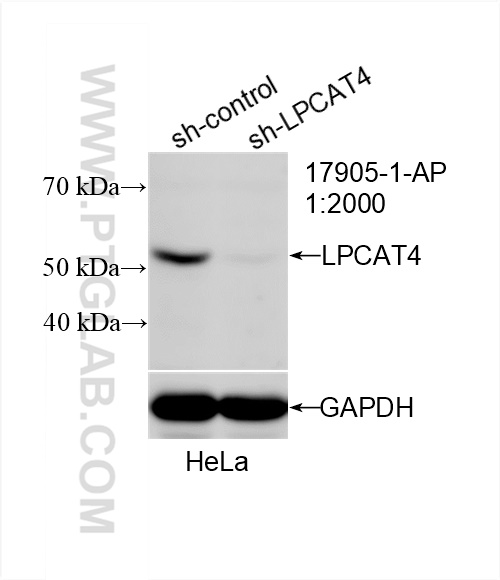 Western Blot (WB) analysis of HeLa cells using LPCAT4 Polyclonal antibody (17905-1-AP)