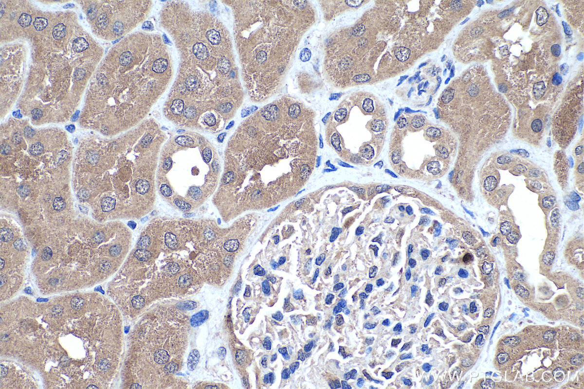 Immunohistochemistry (IHC) staining of human kidney tissue using LPPR2 Polyclonal antibody (25732-1-AP)