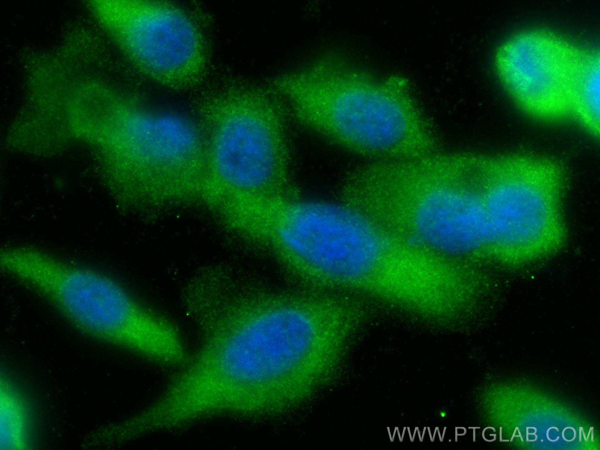 Immunofluorescence (IF) / fluorescent staining of PC-3 cells using LPXN Polyclonal antibody (11307-1-AP)