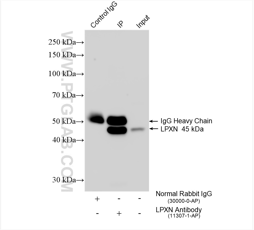 Immunoprecipitation (IP) experiment of PC-3 cells using LPXN Polyclonal antibody (11307-1-AP)