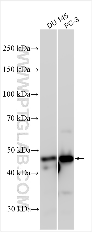 Western Blot (WB) analysis of various lysates using LPXN Polyclonal antibody (11307-1-AP)