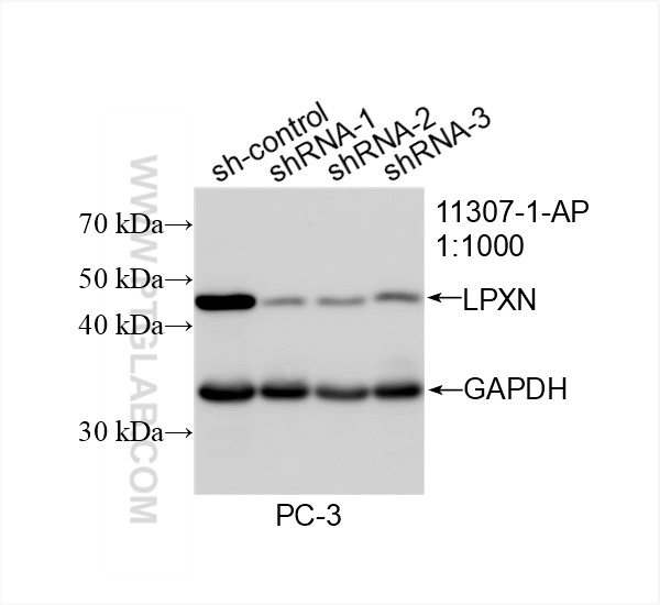 Western Blot (WB) analysis of PC-3 cells using LPXN Polyclonal antibody (11307-1-AP)