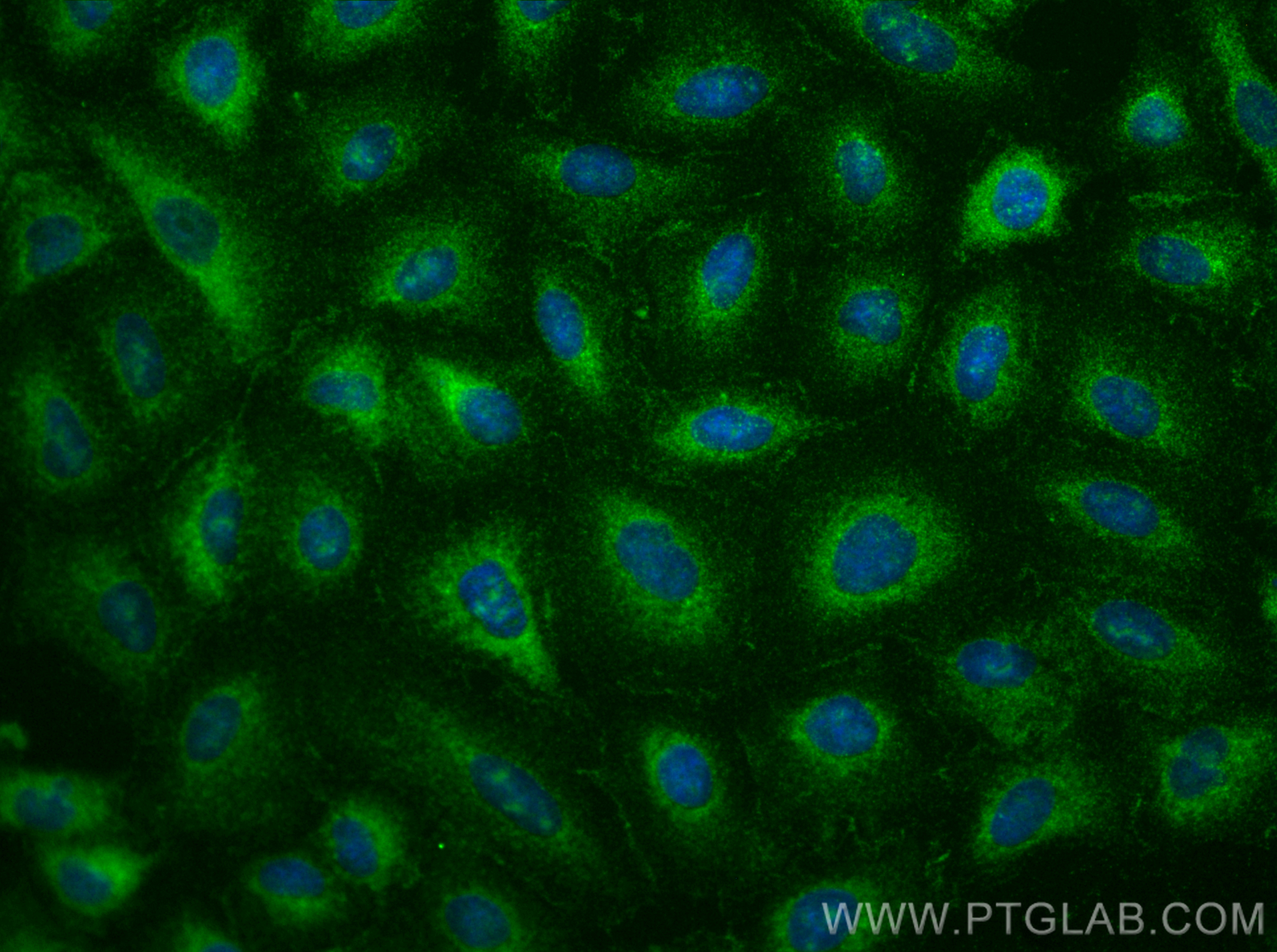 Immunofluorescence (IF) / fluorescent staining of A549 cells using LPXN Polyclonal antibody (31231-1-AP)