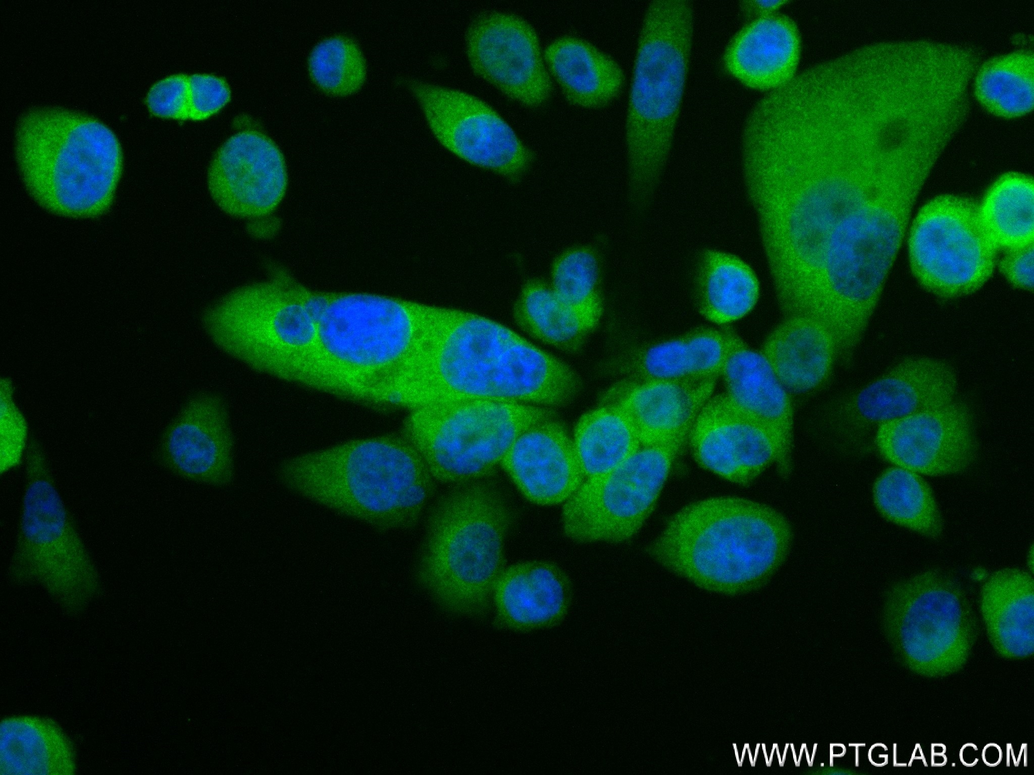 Immunofluorescence (IF) / fluorescent staining of PC-3 cells using LPXN Recombinant antibody (83657-5-RR)