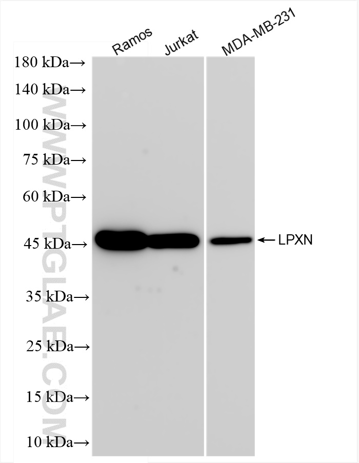 Western Blot (WB) analysis of various lysates using LPXN Recombinant antibody (83657-5-RR)