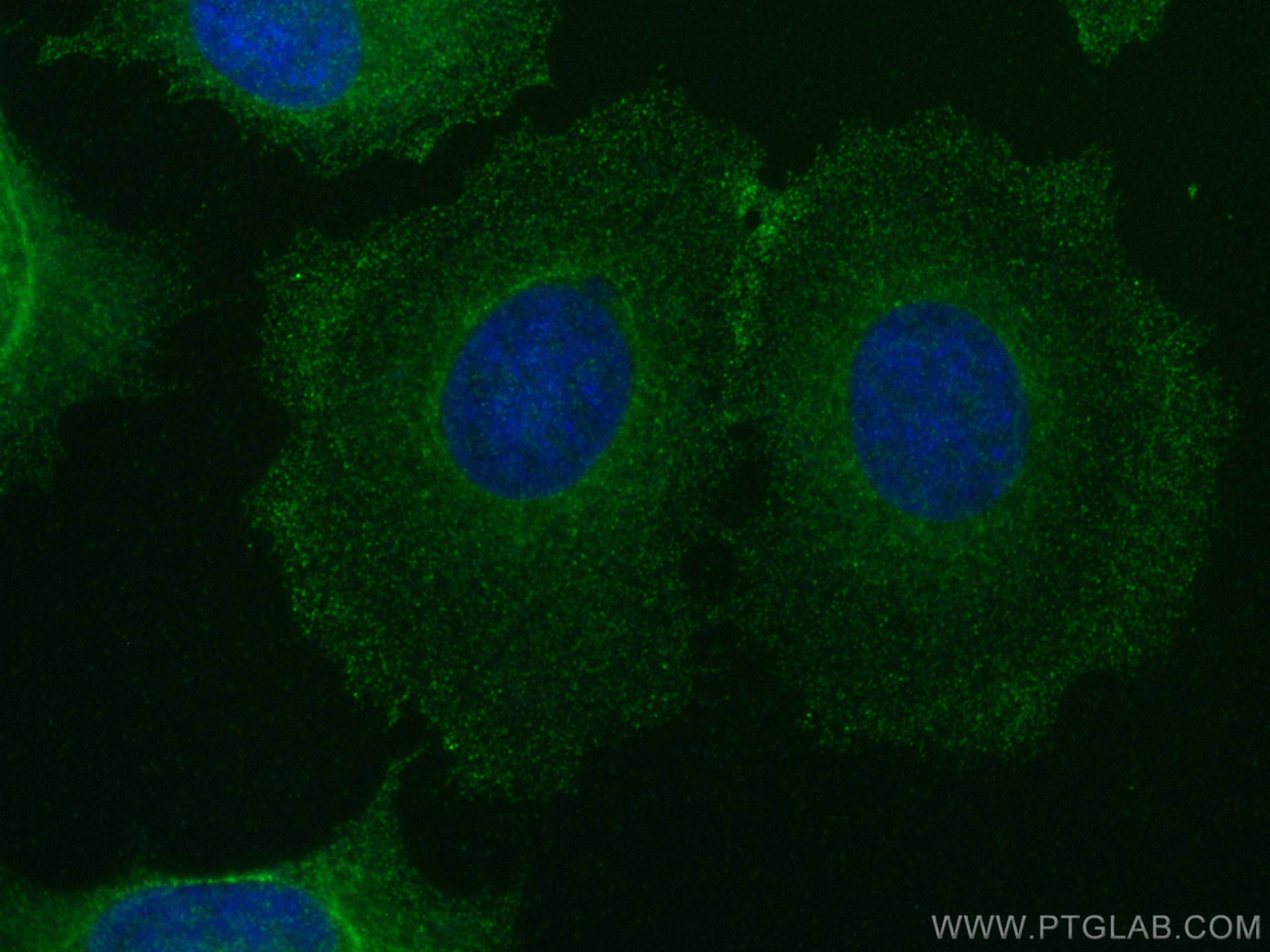 Immunofluorescence (IF) / fluorescent staining of MCF-7 cells using LRCH1 Polyclonal antibody (25017-1-AP)