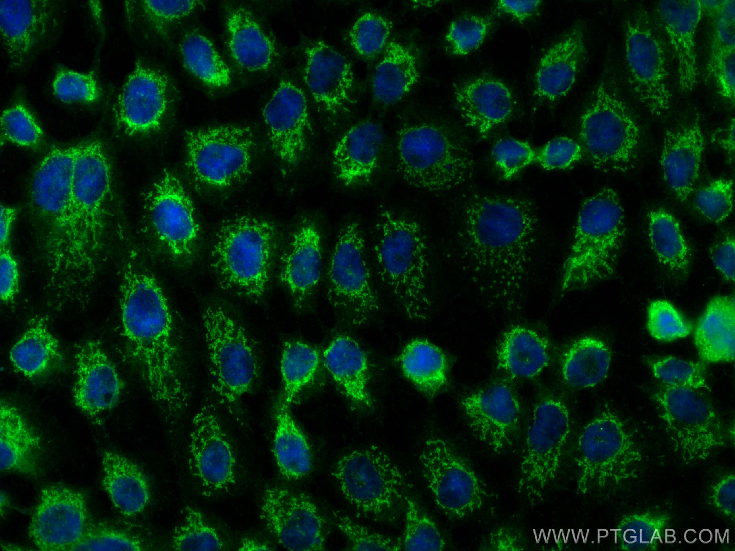 Immunofluorescence (IF) / fluorescent staining of A431 cells using LRCH3 Polyclonal antibody (15800-1-AP)