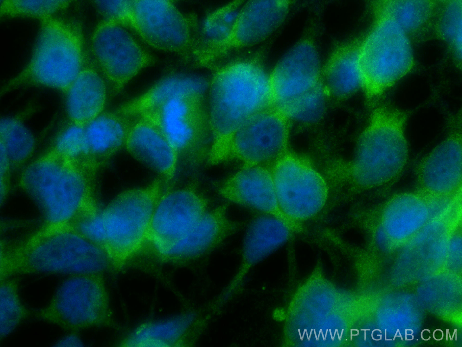Immunofluorescence (IF) / fluorescent staining of HEK-293 cells using LRDD Polyclonal antibody (12119-1-AP)