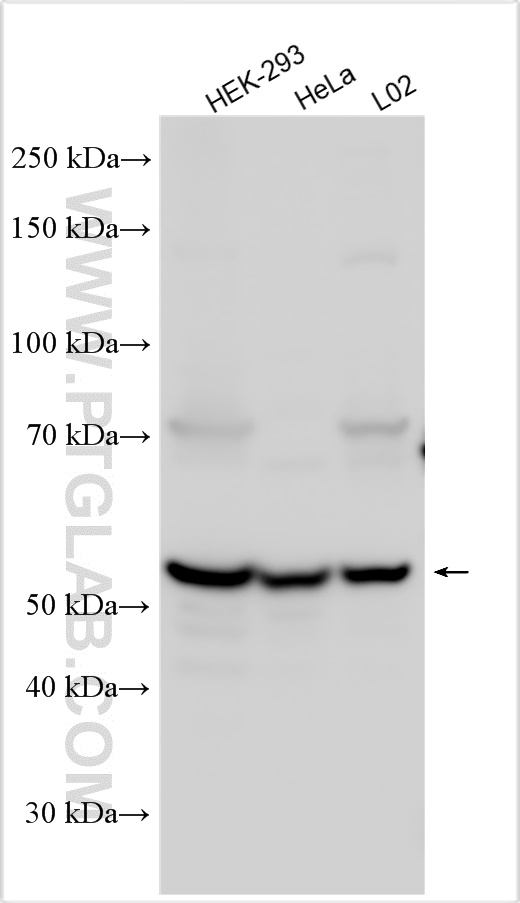 Western Blot (WB) analysis of various lysates using LRDD Polyclonal antibody (12119-1-AP)