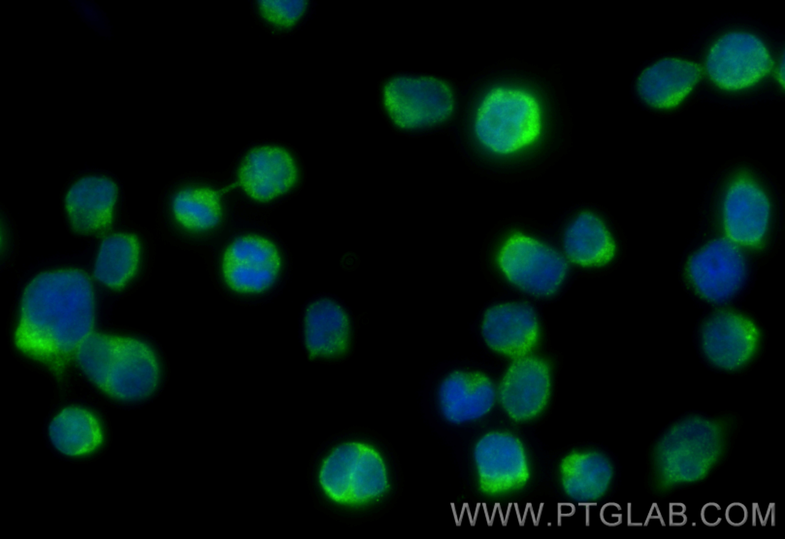 Immunofluorescence (IF) / fluorescent staining of Jurkat cells using LRMP Polyclonal antibody (19498-1-AP)