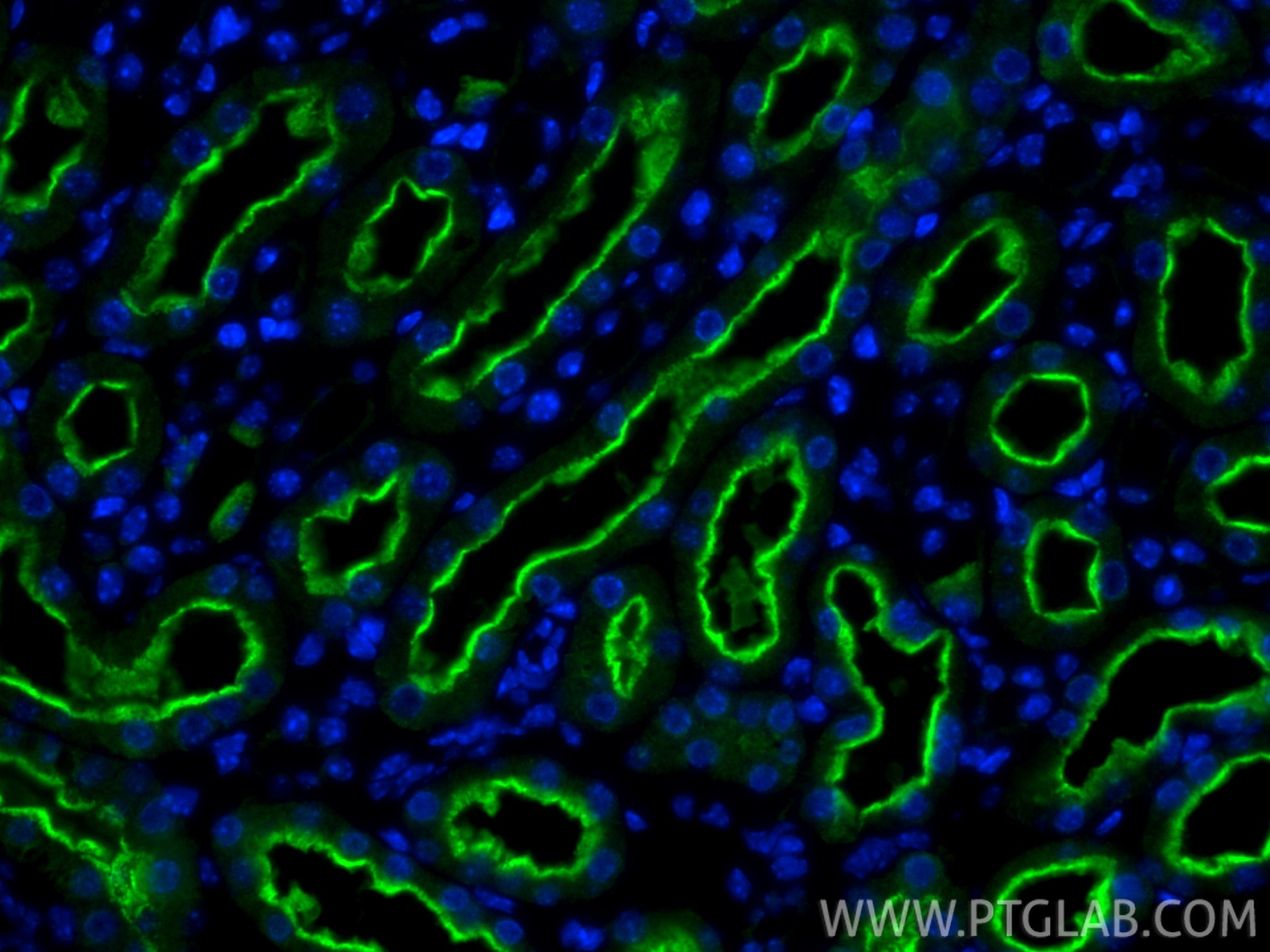 Immunofluorescence (IF) / fluorescent staining of mouse kidney tissue using LRP2-Specific Polyclonal antibody (19700-1-AP)