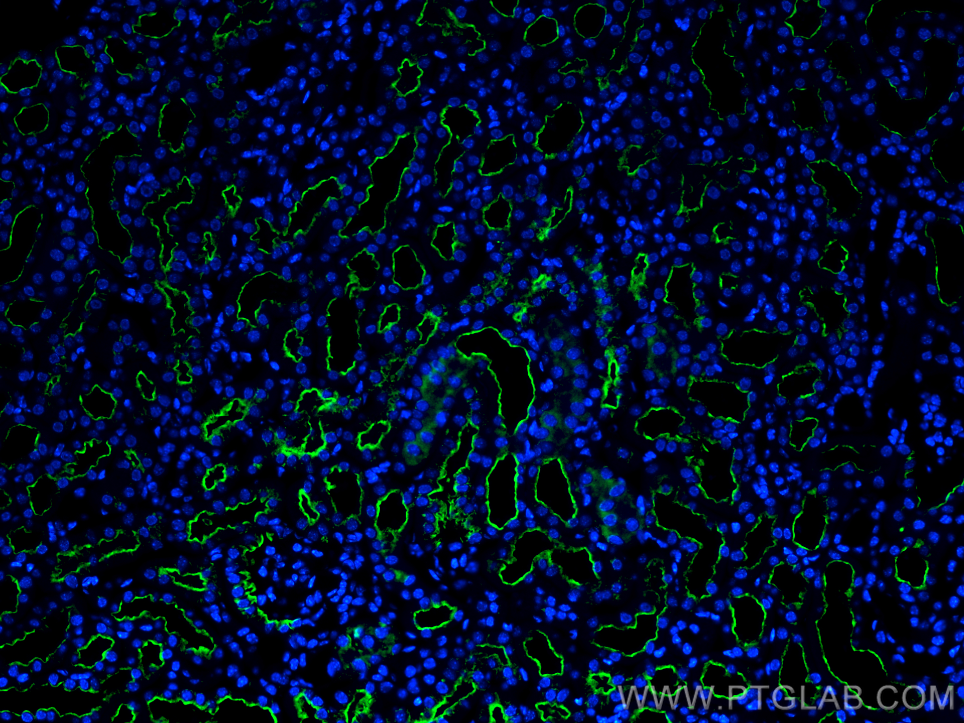 Immunofluorescence (IF) / fluorescent staining of mouse kidney tissue using CoraLite® Plus 488-conjugated LRP2-Specific Polycl (CL488-19700)