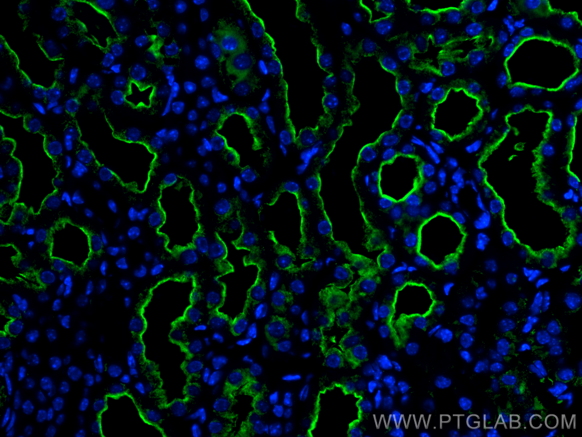 Immunofluorescence (IF) / fluorescent staining of mouse kidney tissue using CoraLite® Plus 488-conjugated LRP2-Specific Polycl (CL488-19700)