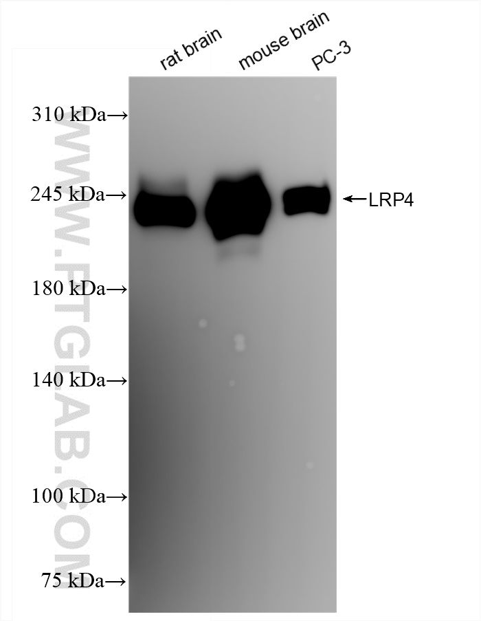 Western Blot (WB) analysis of various lysates using LRP4 Recombinant antibody (84973-1-RR)