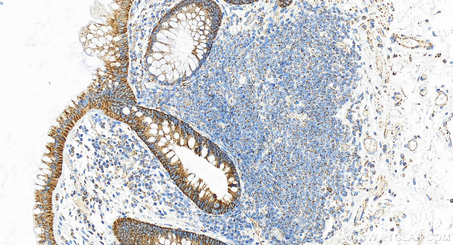 Immunohistochemistry (IHC) staining of human normal colon using LRPPRC Polyclonal antibody (21175-1-AP)