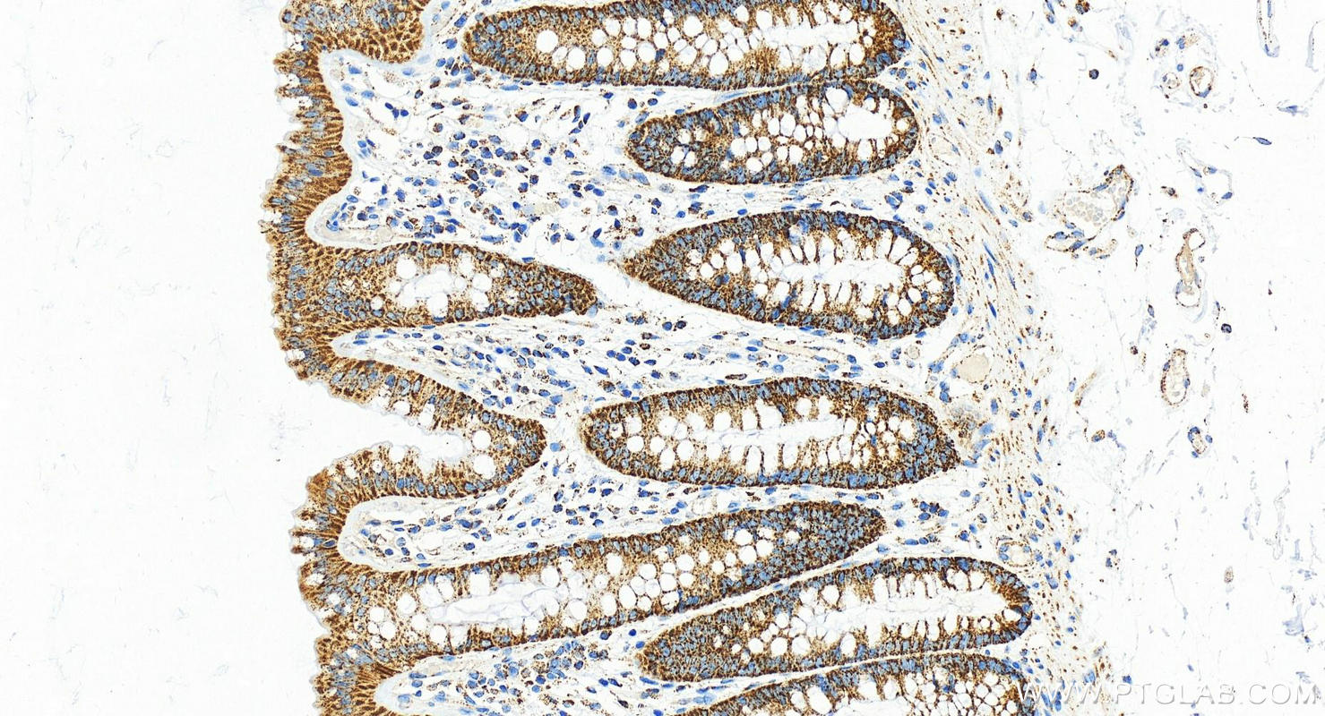 Immunohistochemistry (IHC) staining of human normal colon using LRPPRC Polyclonal antibody (21175-1-AP)