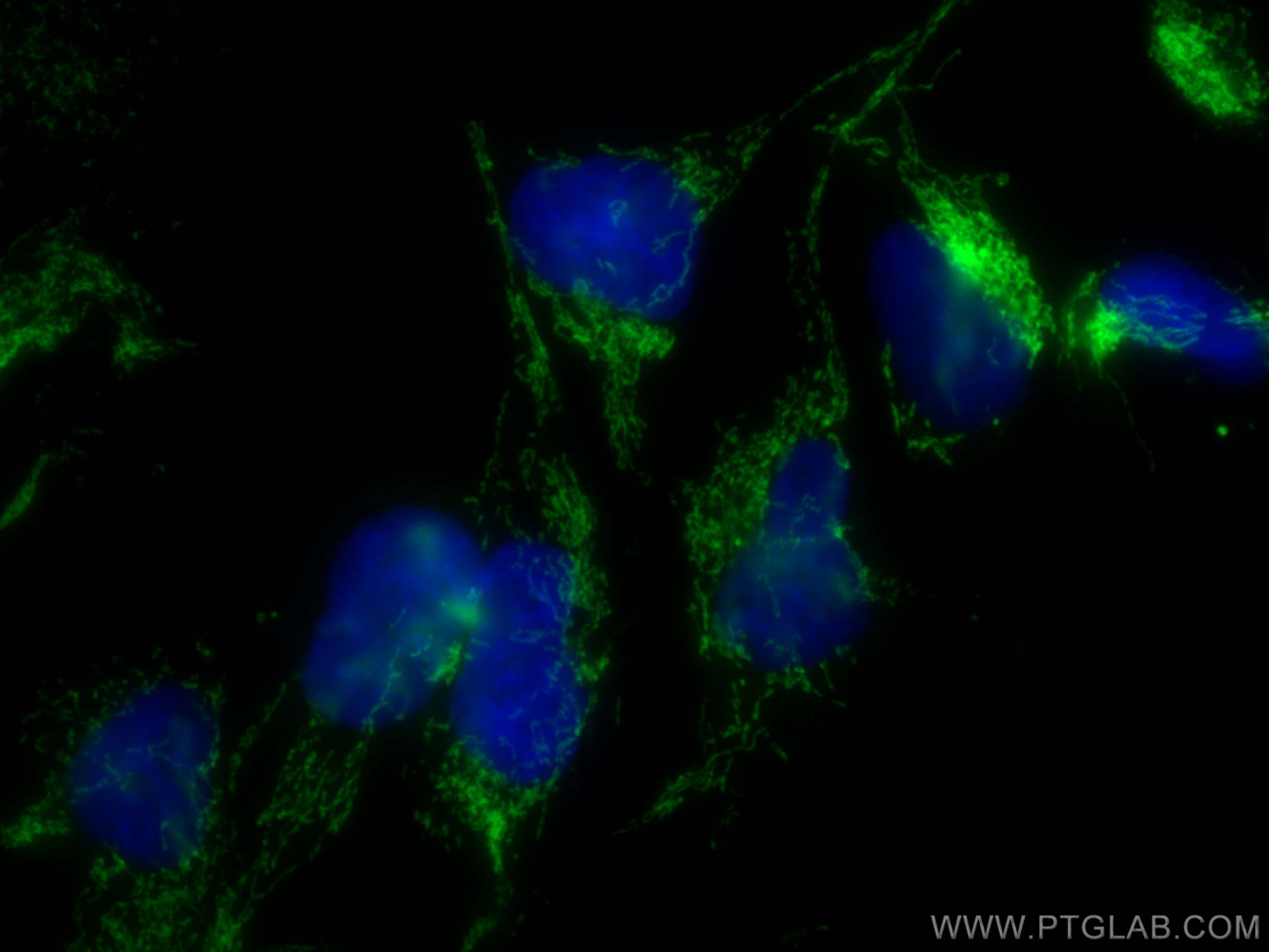 Immunofluorescence (IF) / fluorescent staining of HEK-293 cells using LRPPRC Polyclonal antibody (21175-1-AP)