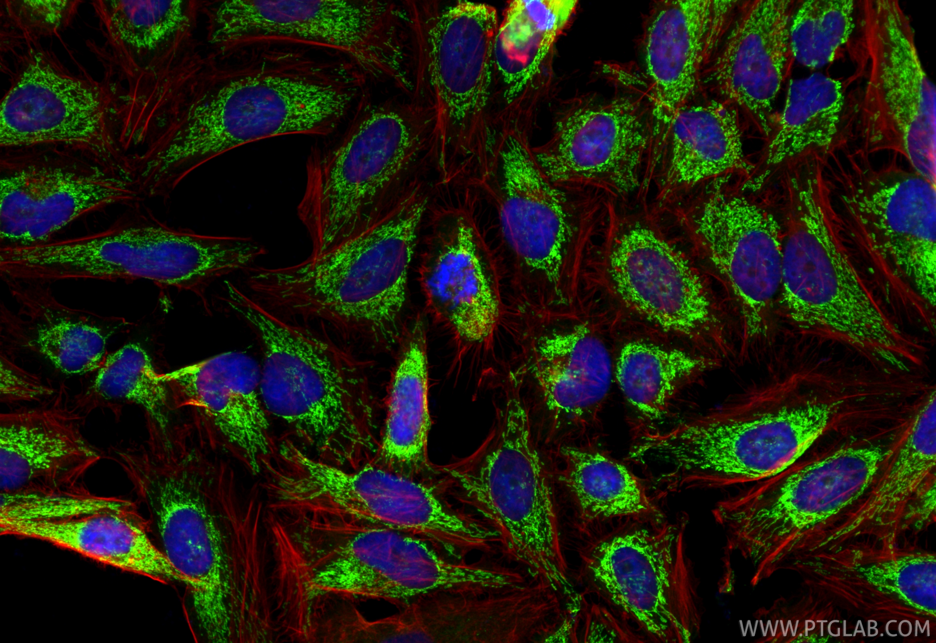 Immunofluorescence (IF) / fluorescent staining of HeLa cells using LRPPRC Polyclonal antibody (21175-1-AP)