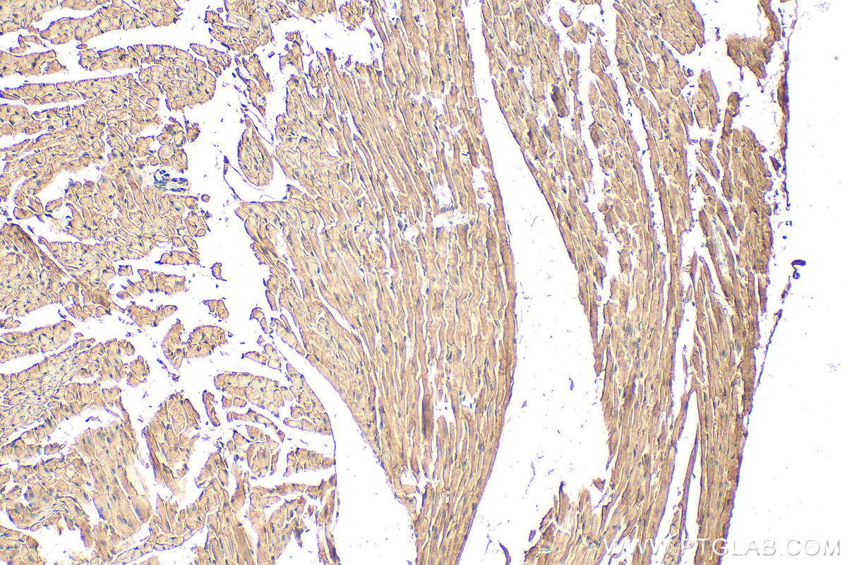Immunohistochemistry (IHC) staining of mouse heart tissue using LRPPRC Polyclonal antibody (21175-1-AP)