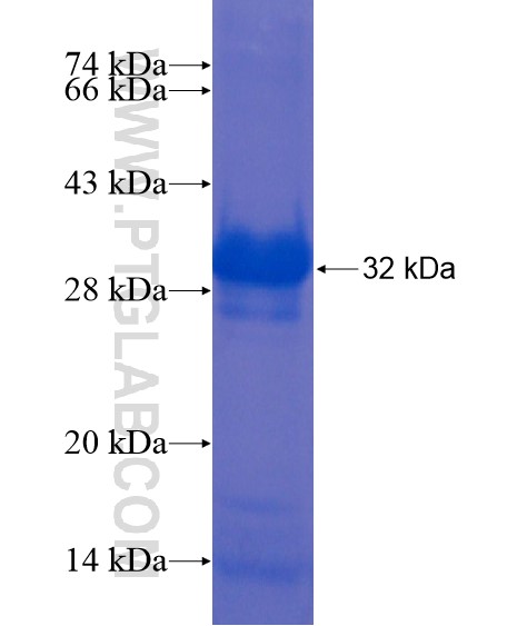 LRRC19 fusion protein Ag21864 SDS-PAGE