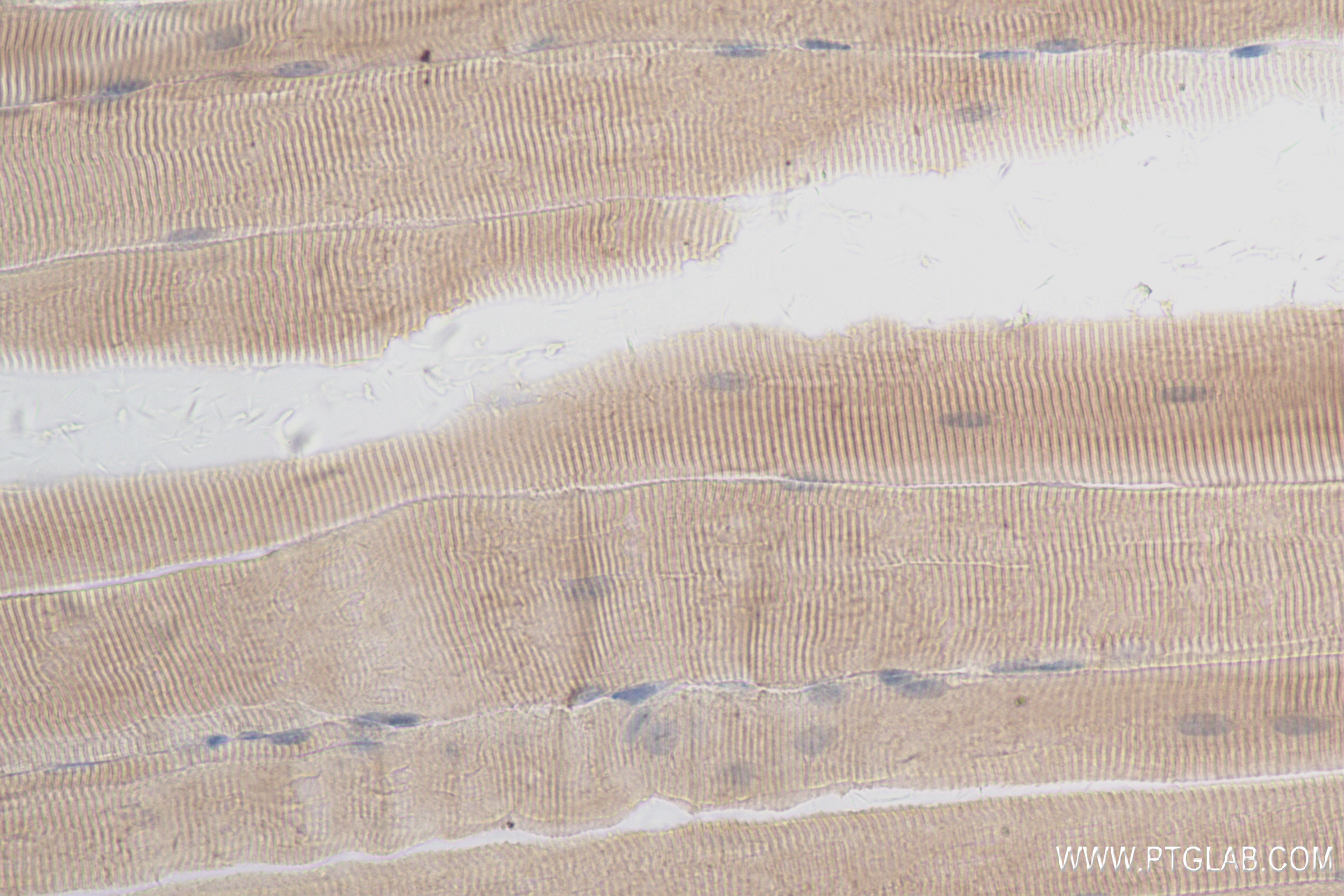 Immunohistochemistry (IHC) staining of mouse skeletal muscle tissue using LRRC2 Recombinant antibody (84404-1-RR)