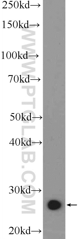 Western Blot (WB) analysis of mouse liver tissue using LRRC29 Polyclonal antibody (25664-1-AP)