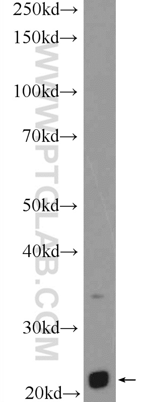 Western Blot (WB) analysis of mouse pancreas tissue using LRRC29 Polyclonal antibody (25664-1-AP)