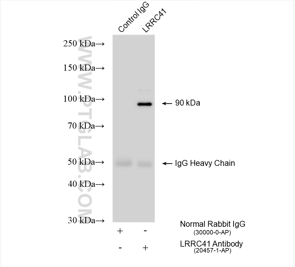 Immunoprecipitation (IP) experiment of K-562 cells using LRRC41 Polyclonal antibody (20457-1-AP)