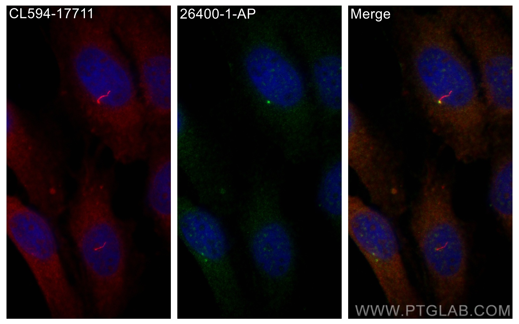 Immunofluorescence (IF) / fluorescent staining of MDCK cells using LRRC6 Polyclonal antibody (26400-1-AP)