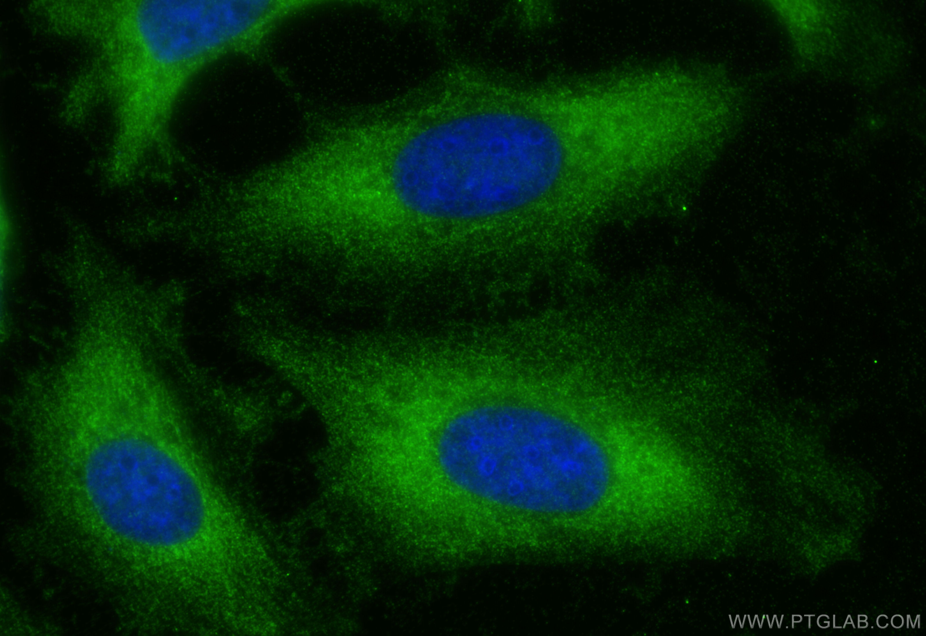 Immunofluorescence (IF) / fluorescent staining of HeLa cells using LRRC8D Polyclonal antibody (11537-1-AP)