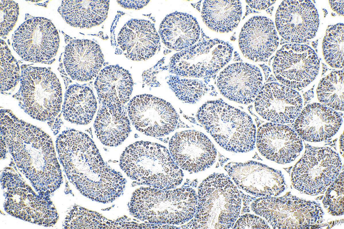 Immunohistochemistry (IHC) staining of mouse testis tissue using LRRCC1 Polyclonal antibody (26317-1-AP)