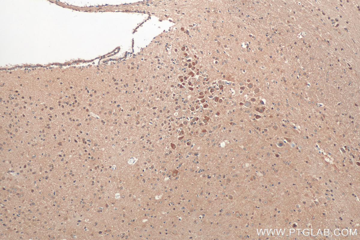 Immunohistochemistry (IHC) staining of mouse cerebellum tissue using LRRCC1 Polyclonal antibody (26317-1-AP)