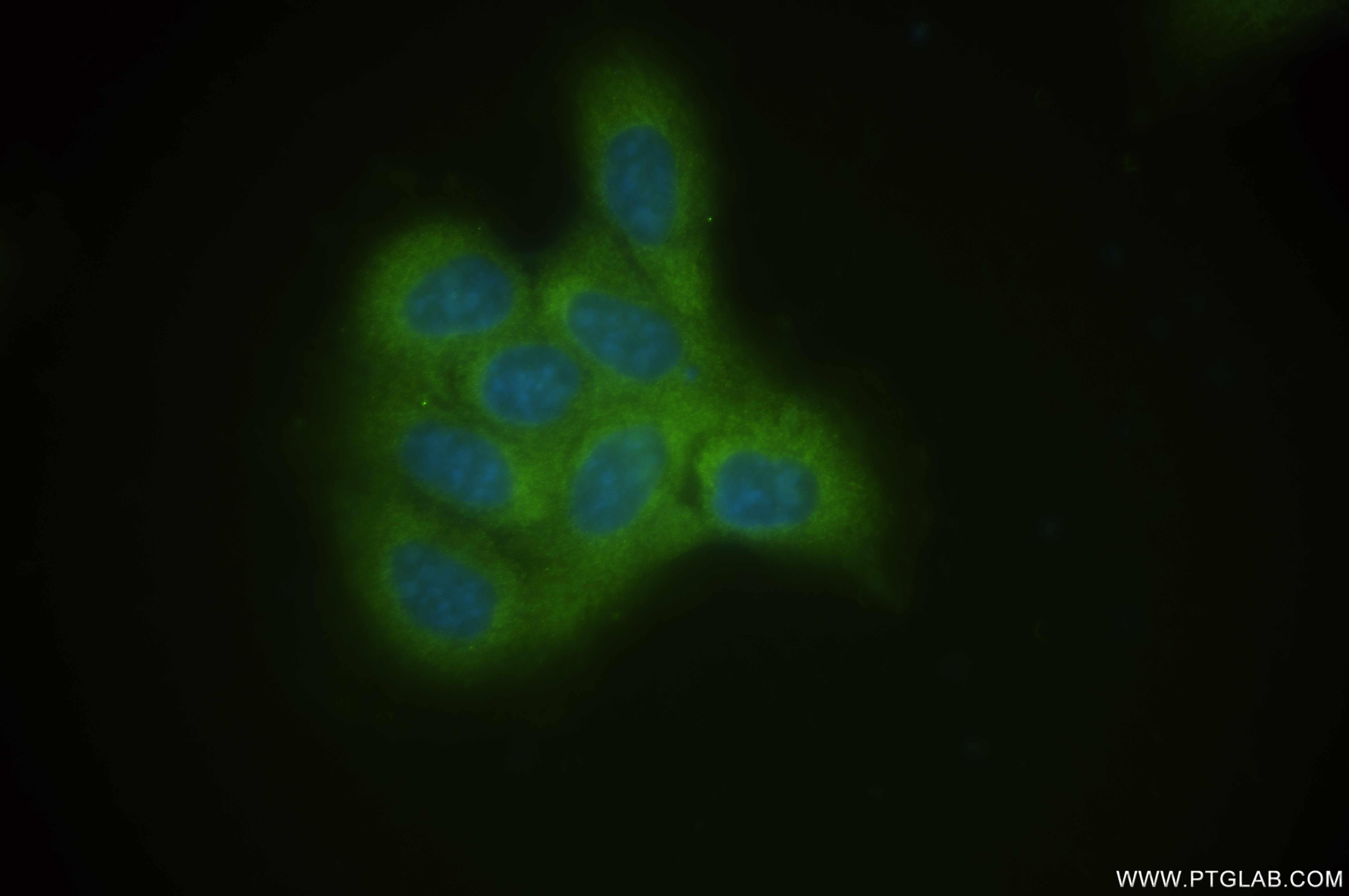 Immunofluorescence (IF) / fluorescent staining of A431 cells using LRRFIP1 Recombinant antibody (84778-4-RR)