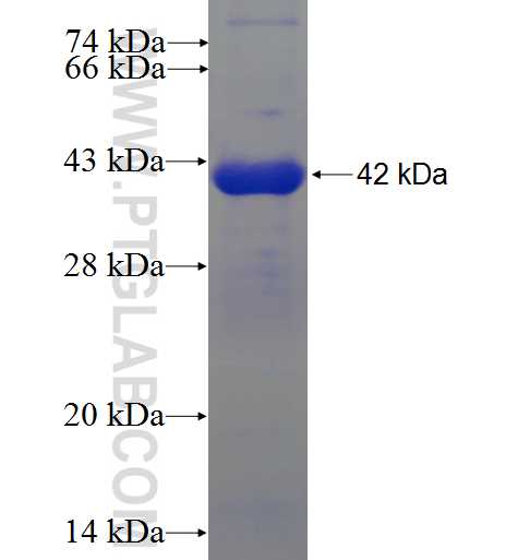 LRRN3 fusion protein Ag4767 SDS-PAGE