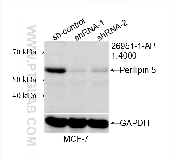 Western Blot (WB) analysis of MCF-7 cells using Perilipin 5 Polyclonal antibody (26951-1-AP)