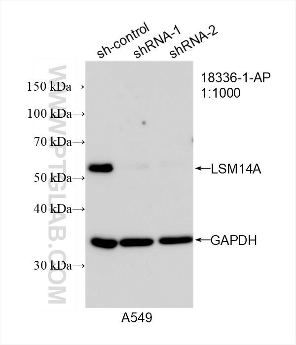 Western Blot (WB) analysis of A549 cells using LSM14A Polyclonal antibody (18336-1-AP)