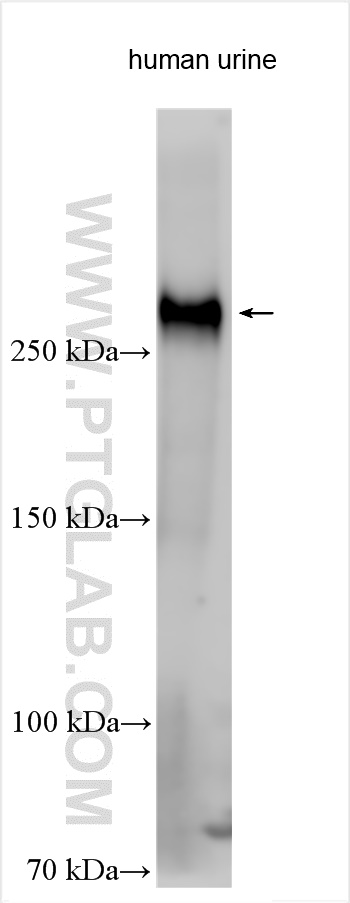 Western Blot (WB) analysis of various lysates using LTBP2 Polyclonal antibody (28824-1-AP)