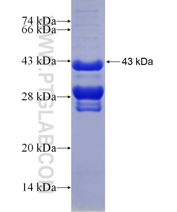 LTBP2 fusion protein Ag29720 SDS-PAGE