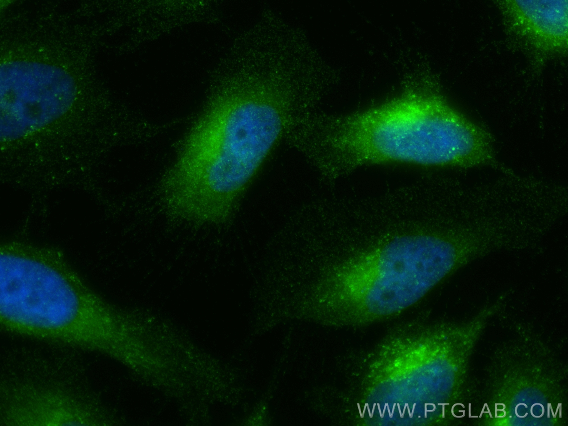 Immunofluorescence (IF) / fluorescent staining of HeLa cells using LTBR Polyclonal antibody (20331-1-AP)