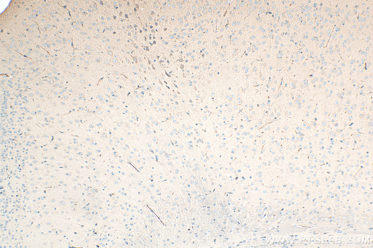 Immunohistochemistry (IHC) staining of mouse brain tissue using Lactotransferrin/LTF Polyclonal antibody (10933-1-AP)