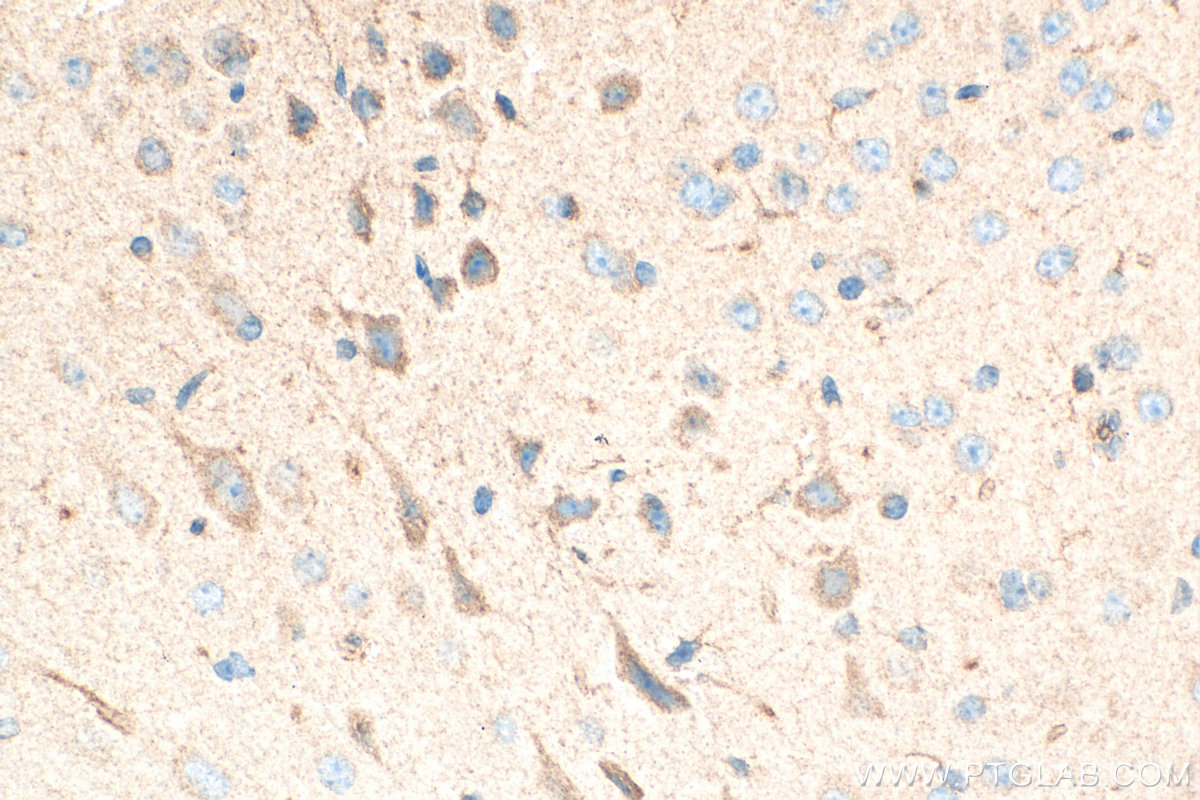 Immunohistochemistry (IHC) staining of mouse brain tissue using Lactotransferrin/LTF Polyclonal antibody (10933-1-AP)