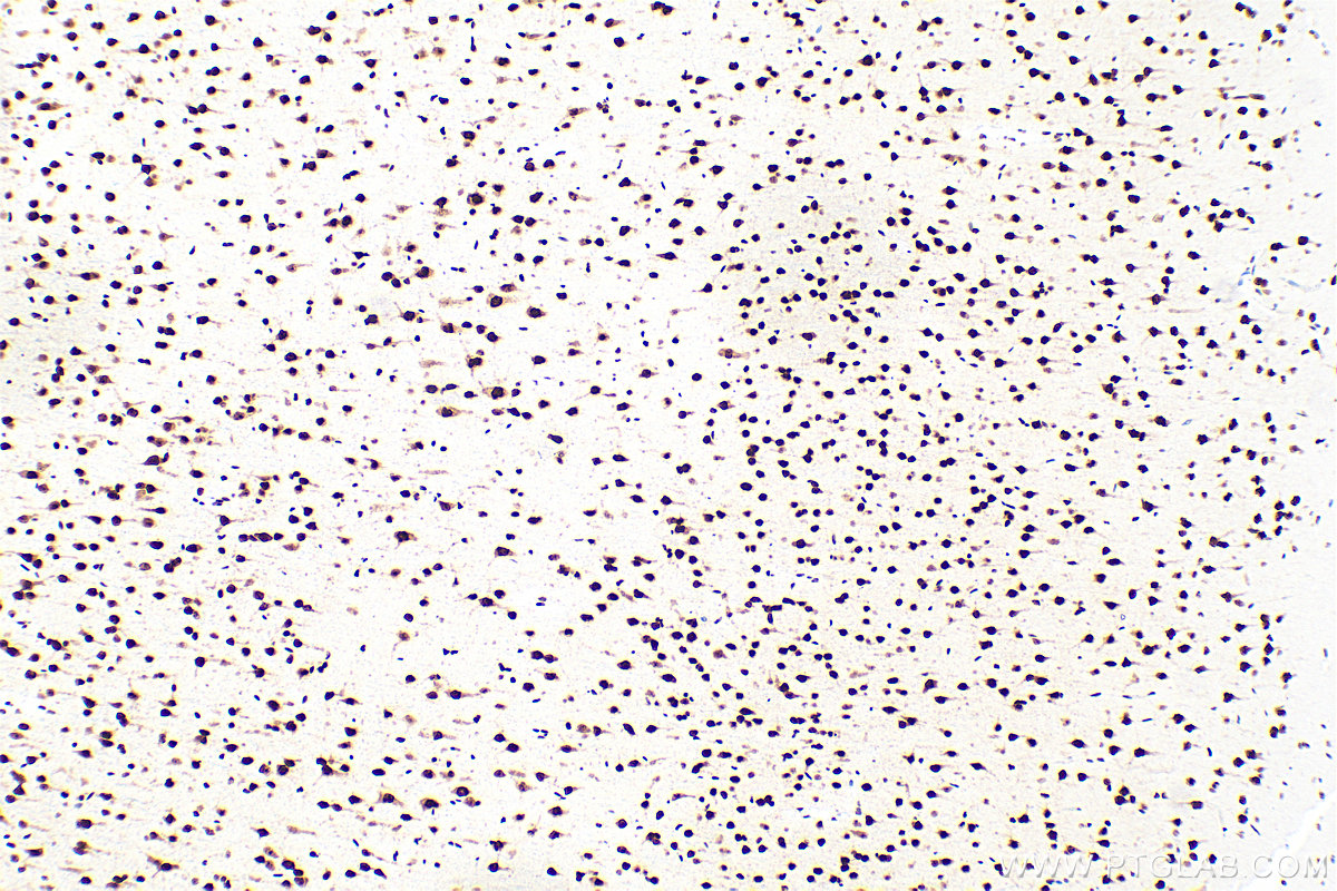 Immunohistochemistry (IHC) staining of rat brain tissue using LUC7L Recombinant antibody (83585-1-RR)