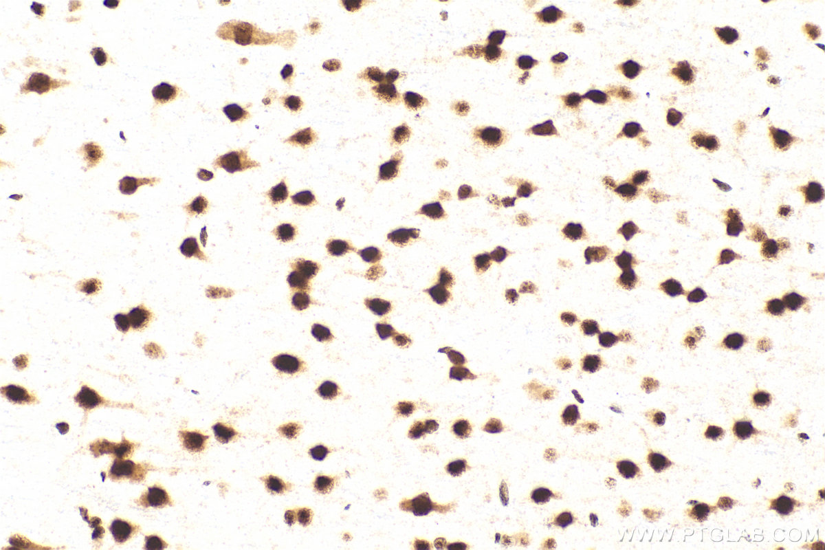 Immunohistochemistry (IHC) staining of rat brain tissue using LUC7L Recombinant antibody (83585-1-RR)