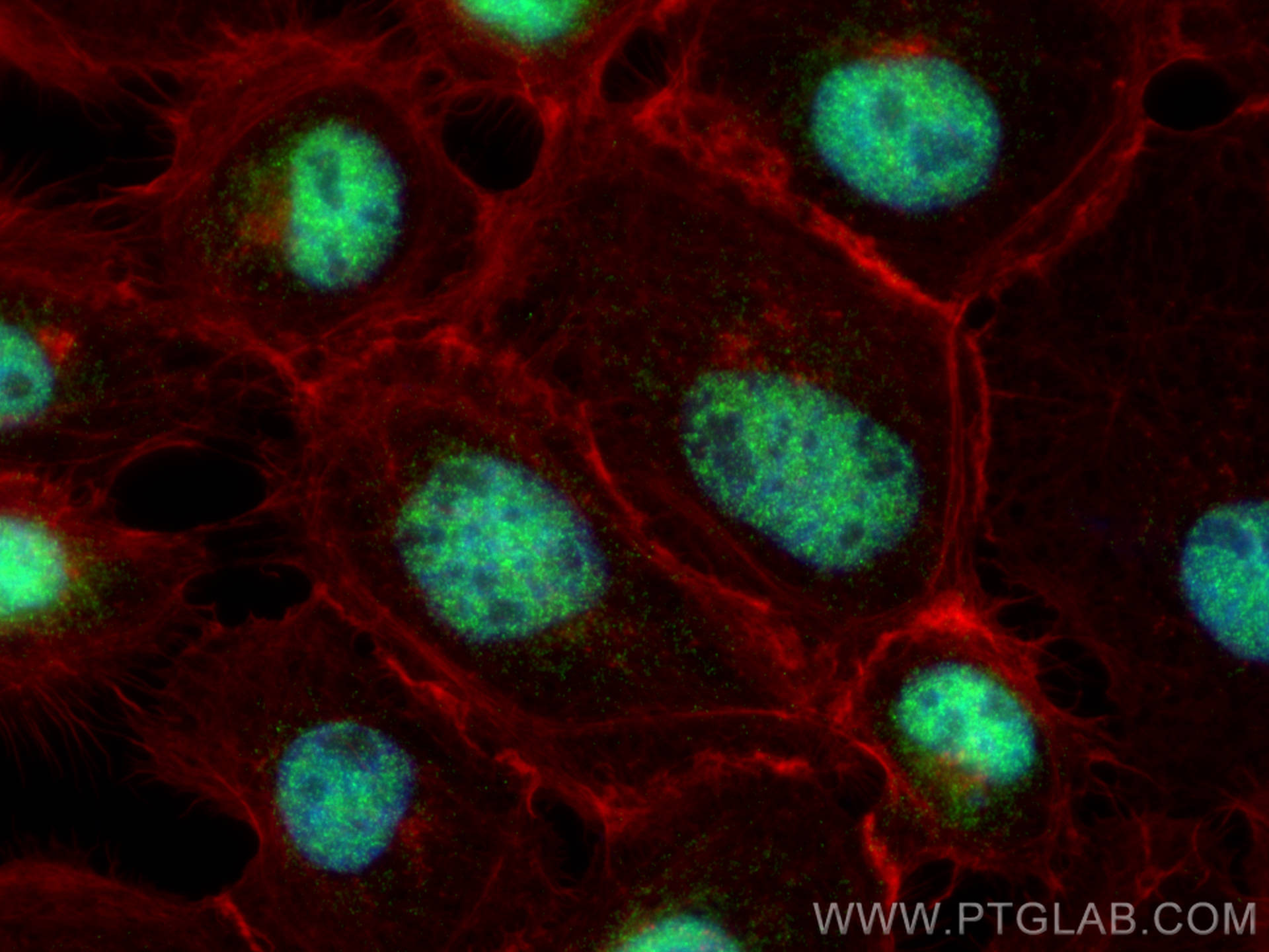 Immunofluorescence (IF) / fluorescent staining of A431 cells using LUC7L2 Polyclonal antibody (24202-1-AP)