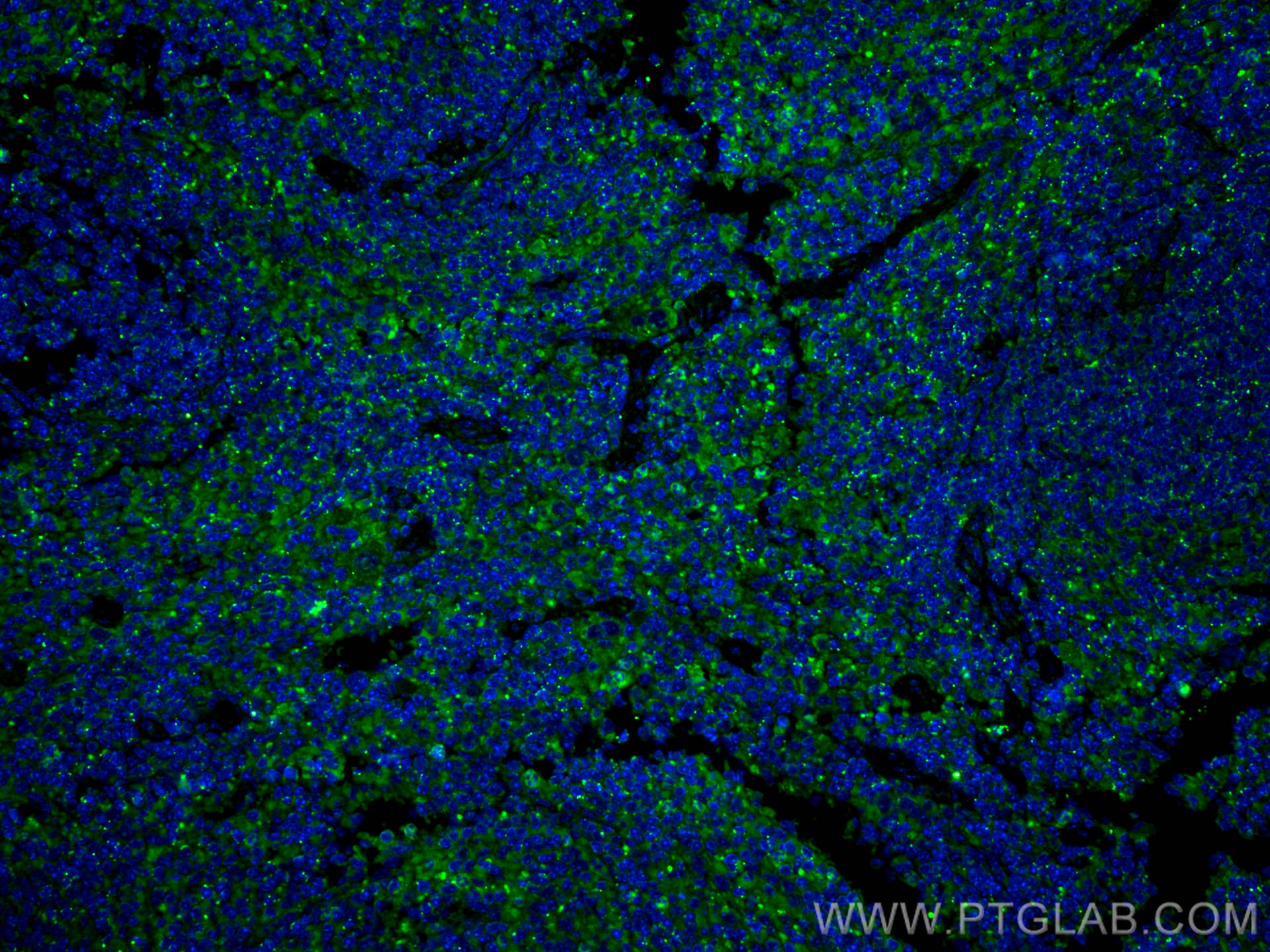 Immunofluorescence (IF) / fluorescent staining of mouse spleen tissue using Lumican Polyclonal antibody (10677-1-AP)