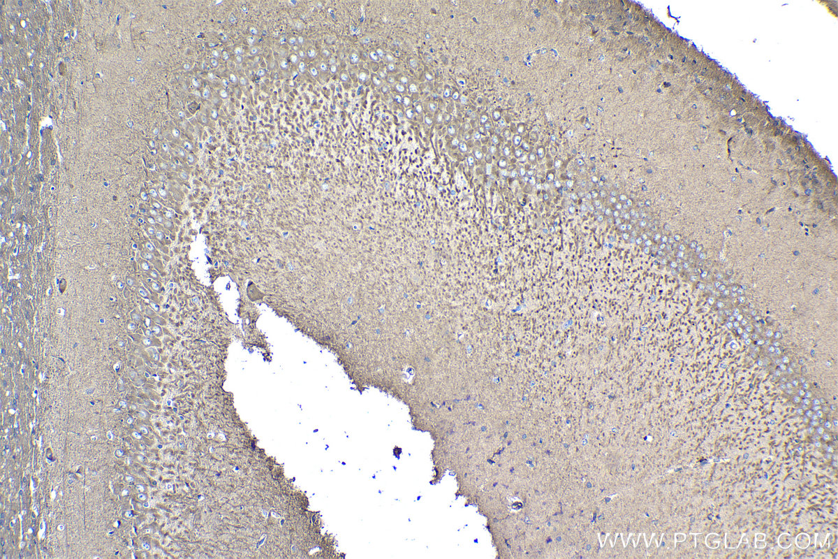 Immunohistochemistry (IHC) staining of rat brain tissue using LUZP1 Polyclonal antibody (17483-1-AP)