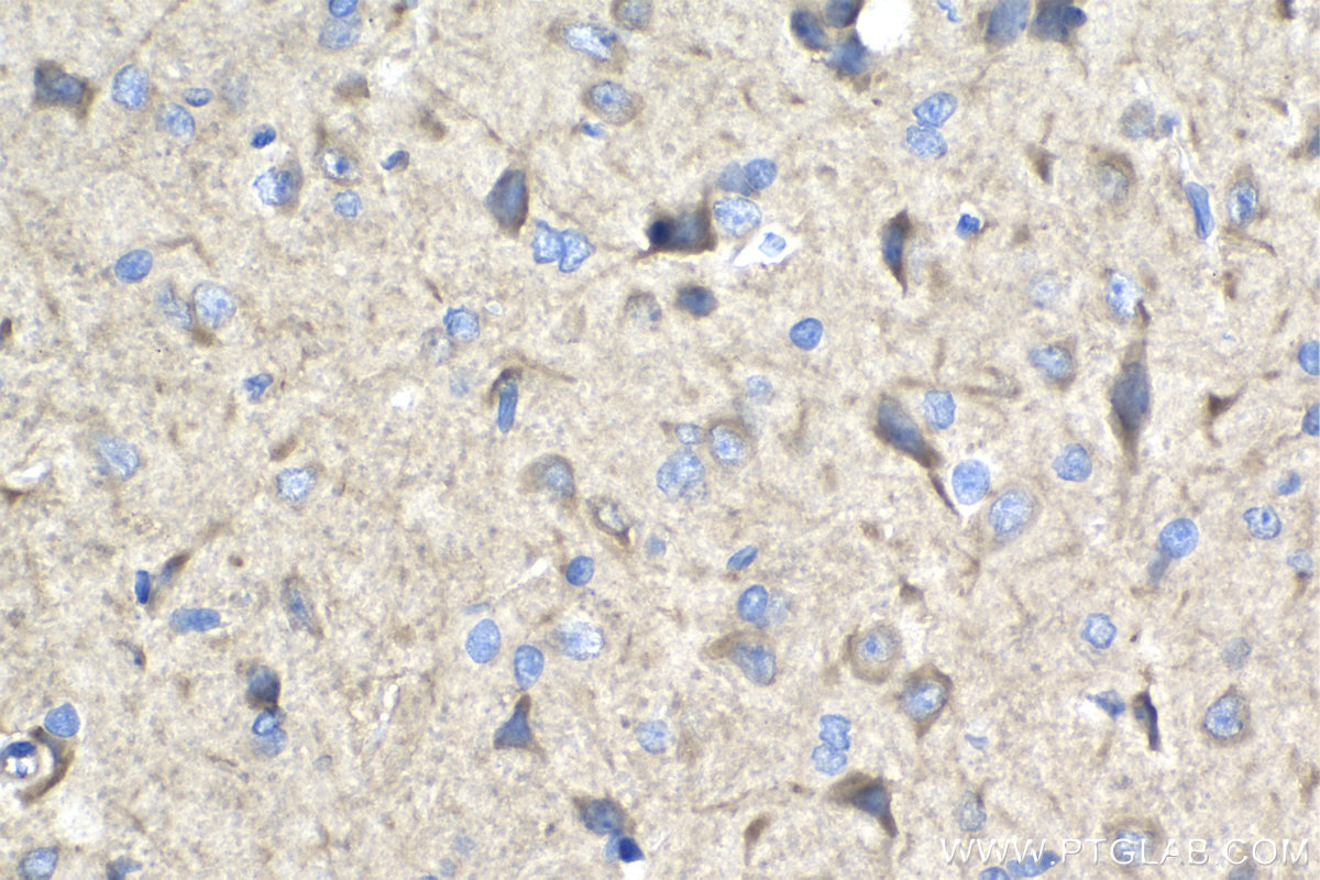 Immunohistochemistry (IHC) staining of rat brain tissue using LUZP1 Polyclonal antibody (17483-1-AP)